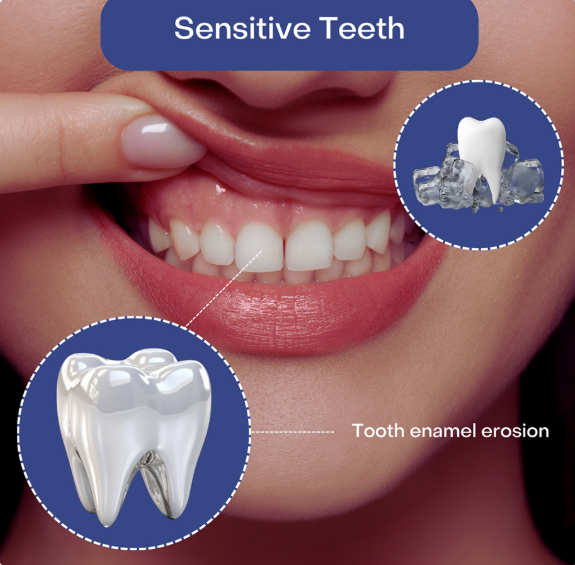 Teeth Sensitivity
