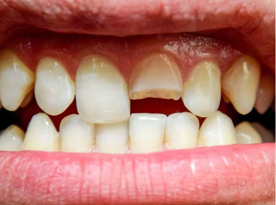 Dental Emergency