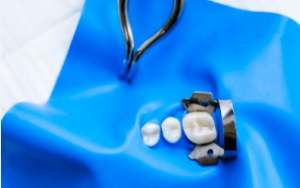 Rubber Dam in Dental Treatment: The Essential Safeguard