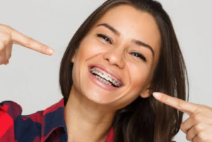 Braces as an Adult: 5 Truths That Prove It’s Never Too Late