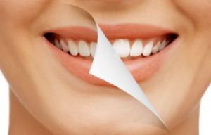 Smile Makeover: The Ultimate Guide to a Confident New You