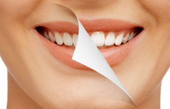 Smile Makeover