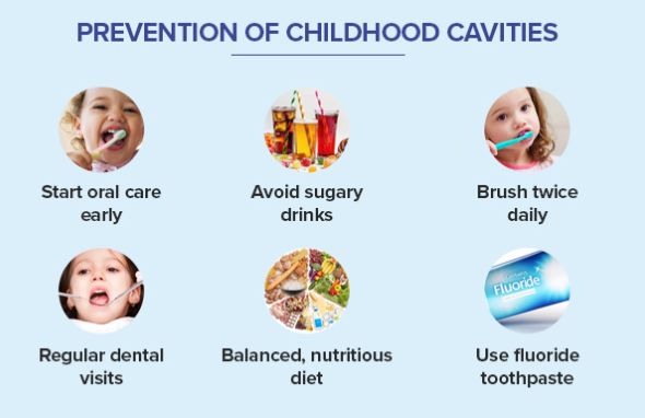 Preventing Cavities in Children