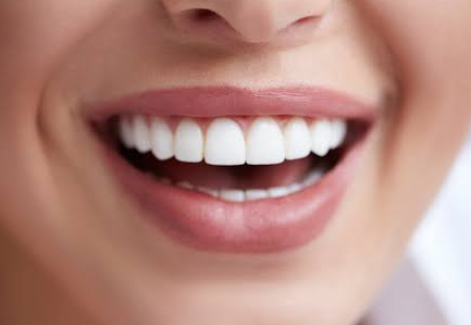 What Your Smile Says About You