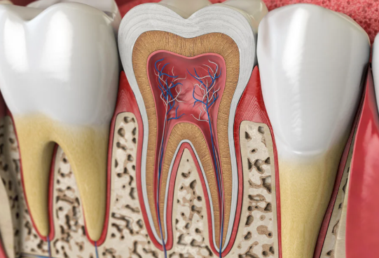 Root Canal Failing Years Later